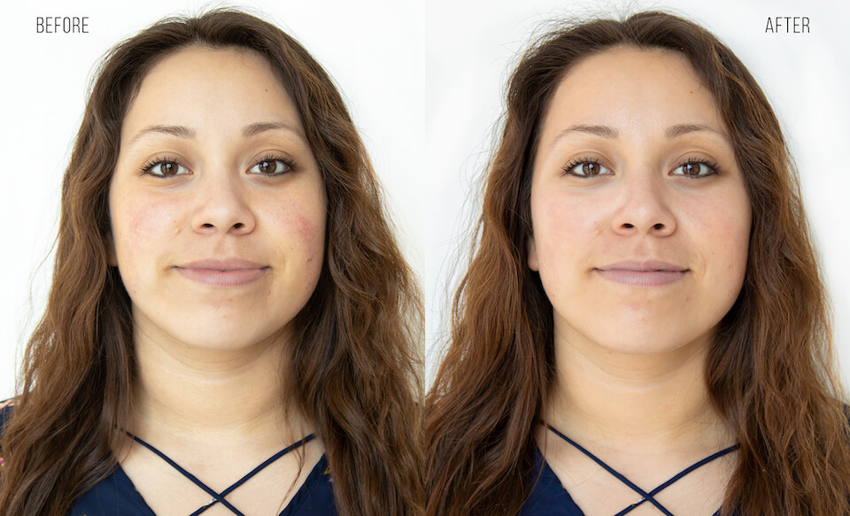 Before and after of young woman.